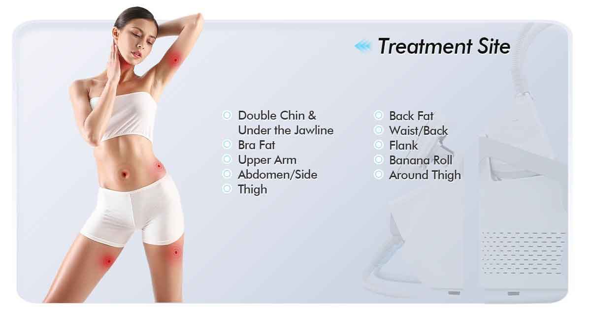 Portable Cryolipolysis of Suppliers