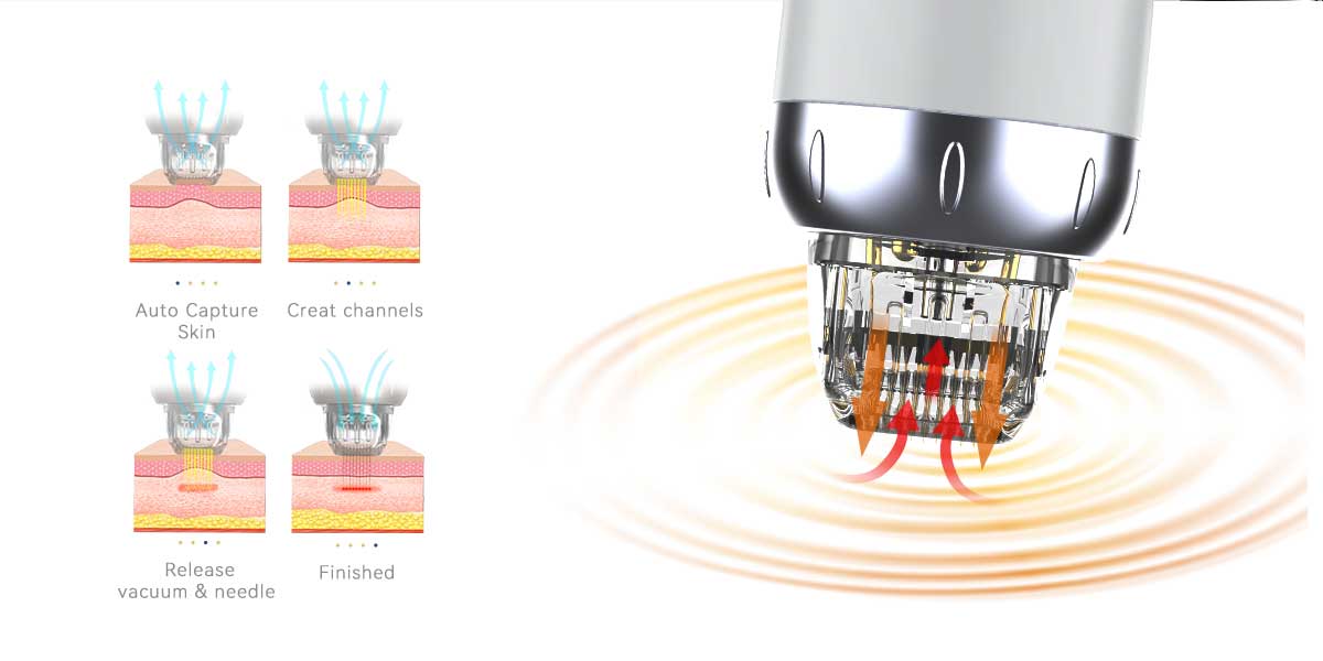 Fractional Microneedling Machine of Manufactuers