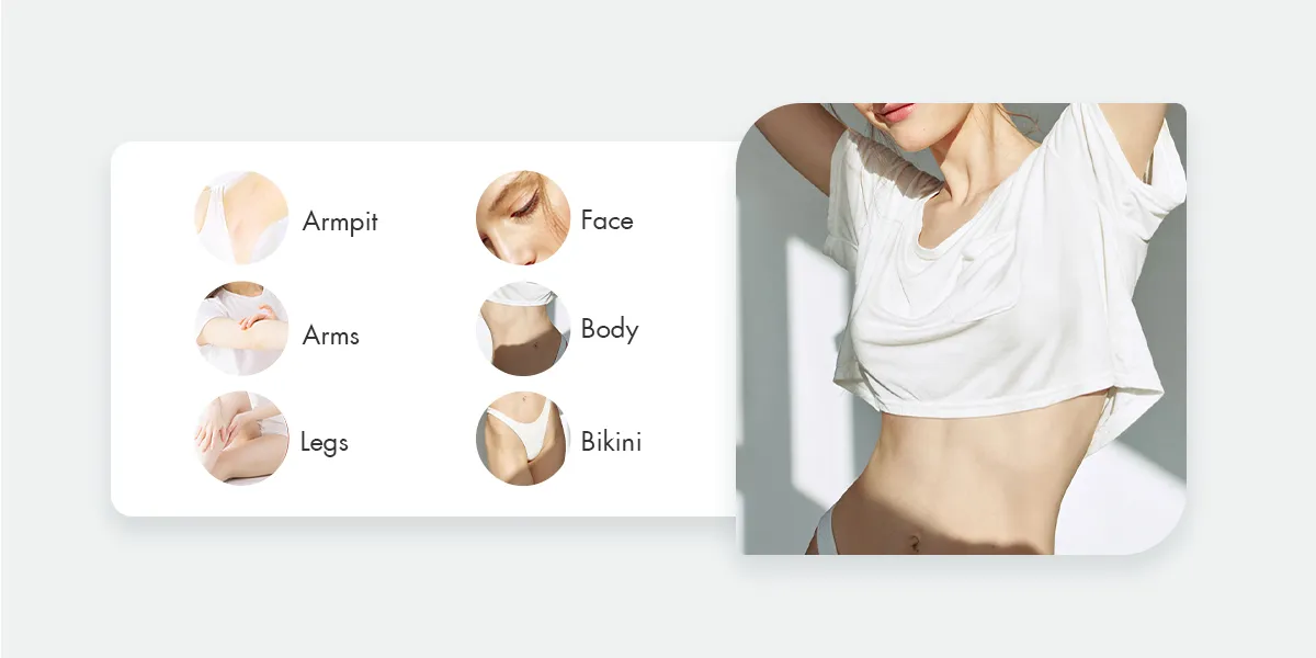 حذف موی لیزر: